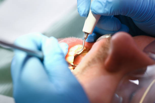 Best Same-Day Emergency Dental Services in Berryville, TX