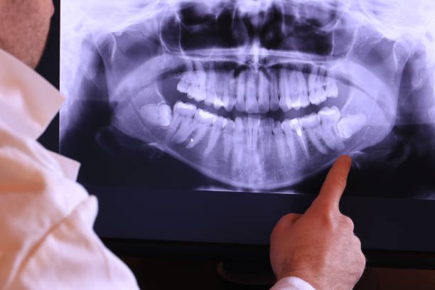 Best Emergency Dental Care for Broken or Chipped Teeth in Berryville, TX